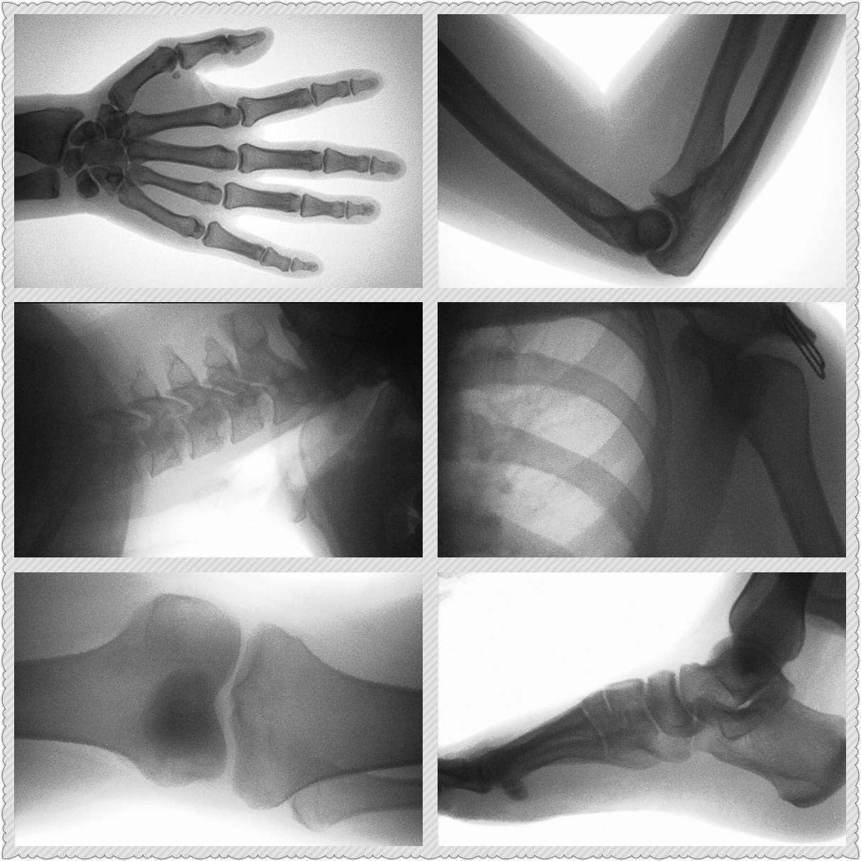 Rapid Diagnosis of Fracture in - Veterinary X-Ray 评论和价格